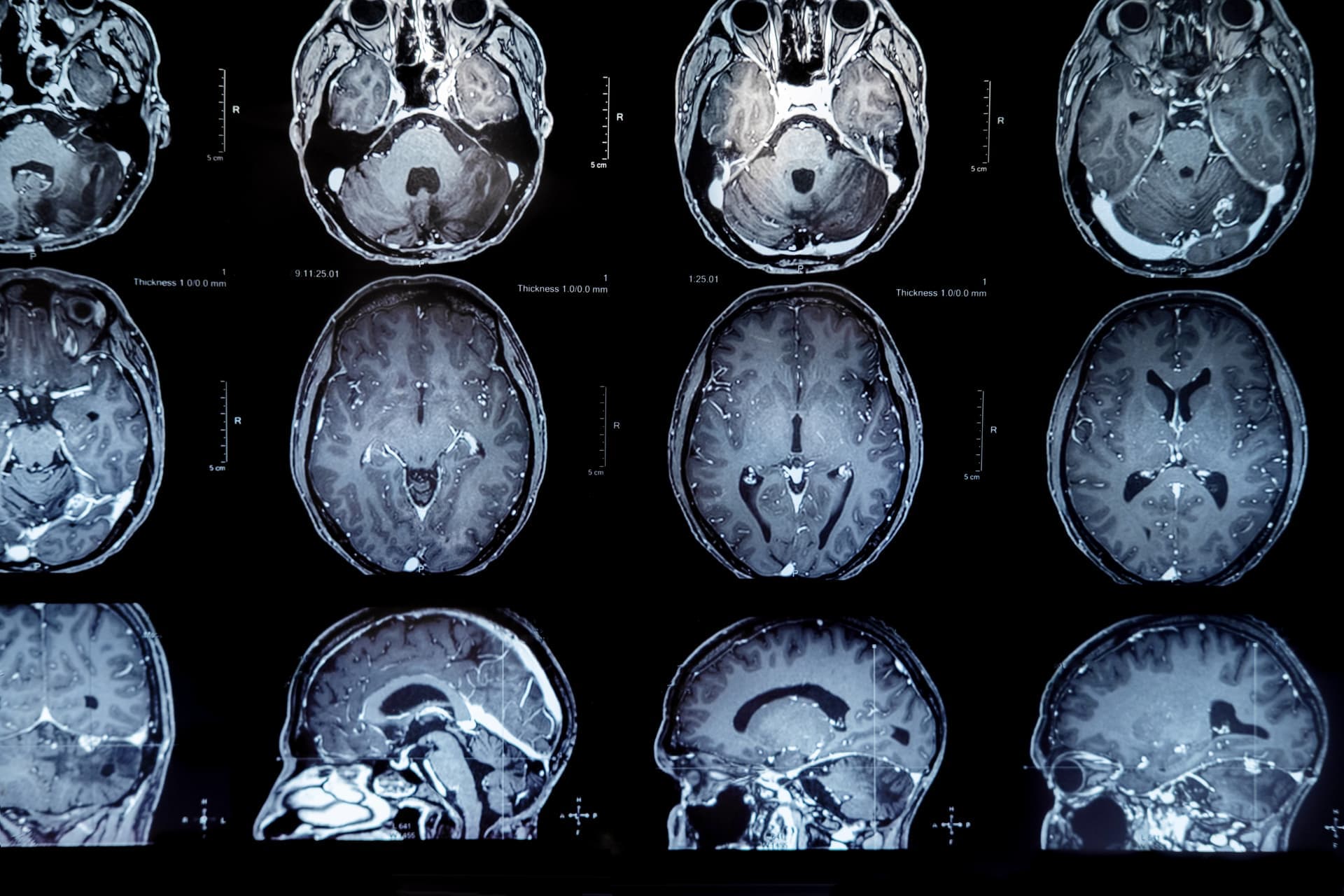 Neurology & Neuromodulation