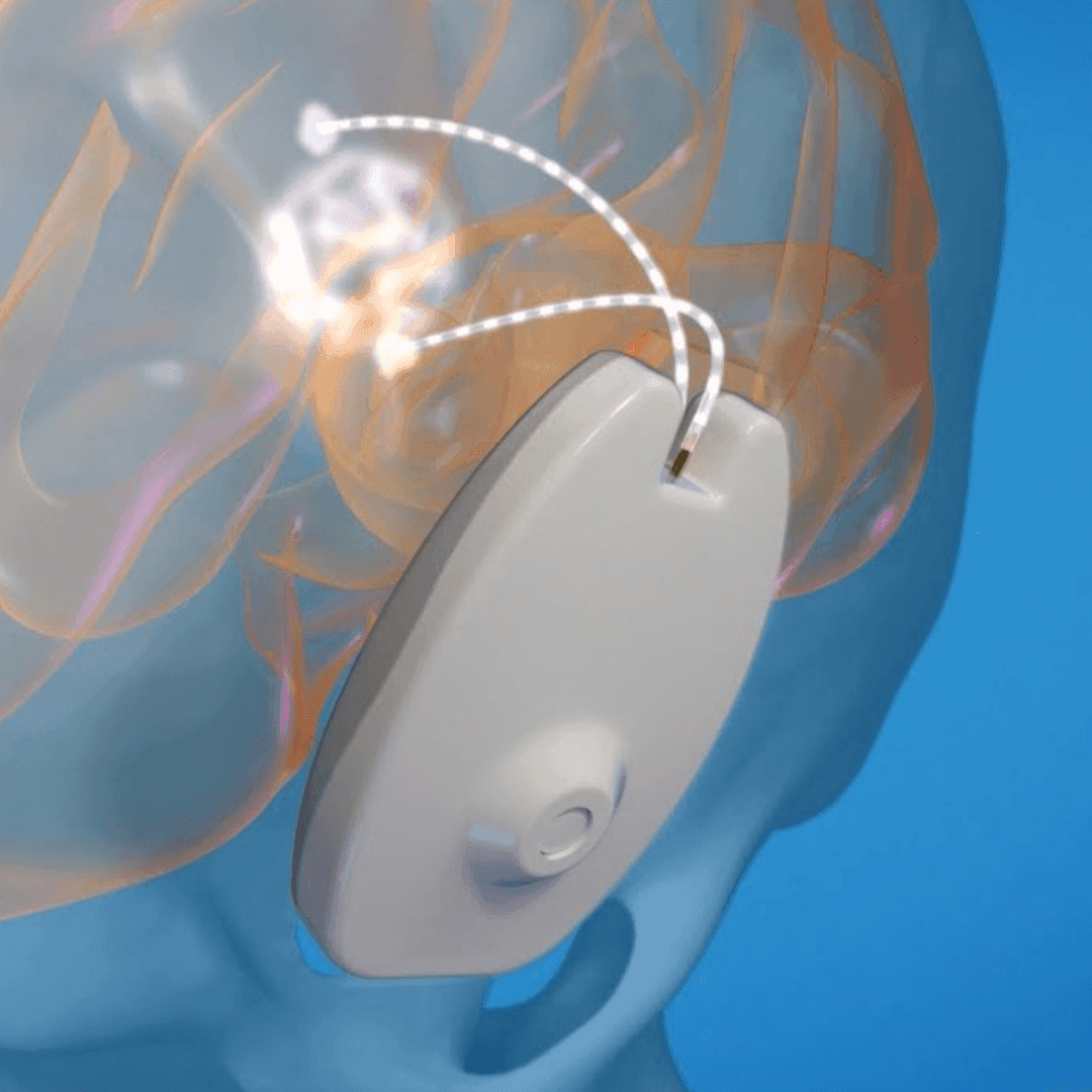 CraniUS closes $20M financing to support blood-brain barrier tech for drug delivery