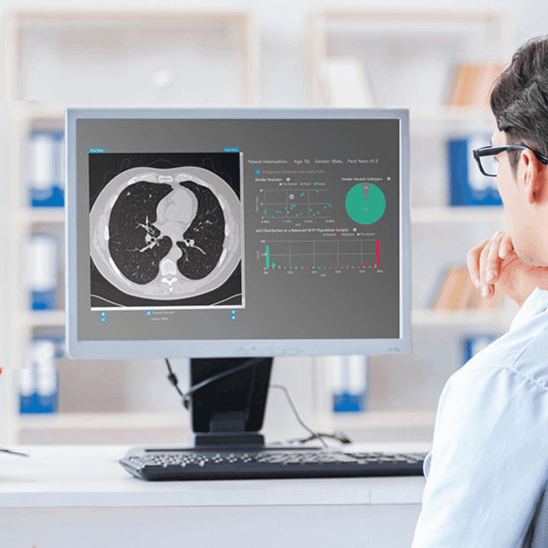 FDA clears RevealDX’s AI lung nodule diagnostic