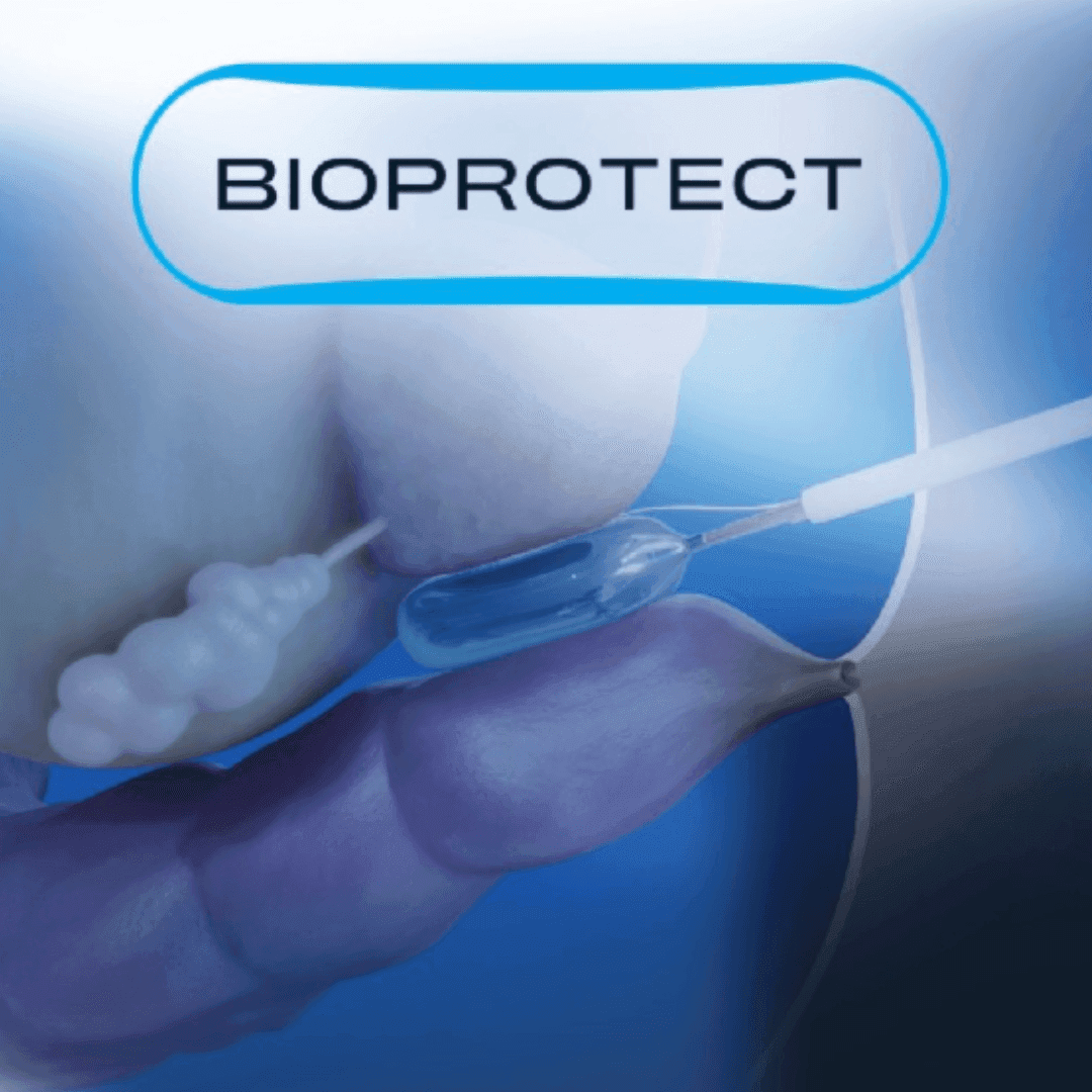 Olympus agrees $270M BioProtect buyout to expand prostate cancer offerings