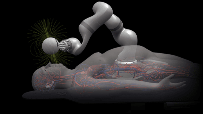 Magnendo raises $18M Series A to advance magnetic robotic navigation for stroke care