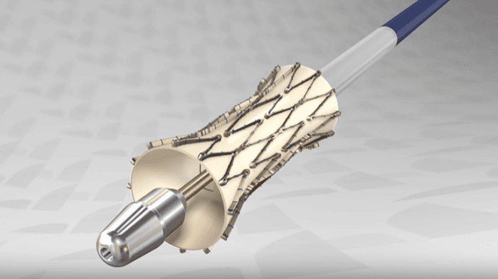 enVVeno Medical wins FDA IDE for pivotal trial of transcatheter venous valve
