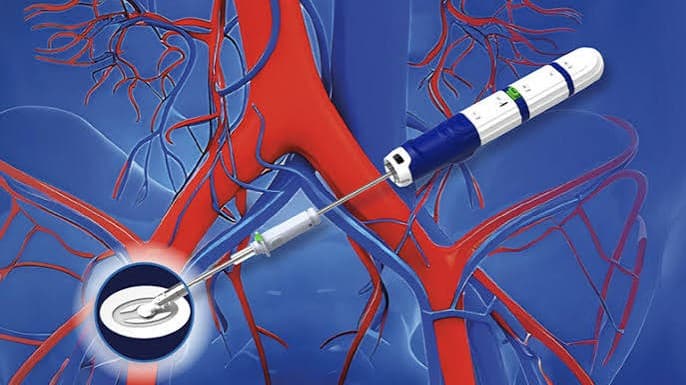 Haemonetics wins FDA approval for PerQseal Elite vascular closure system