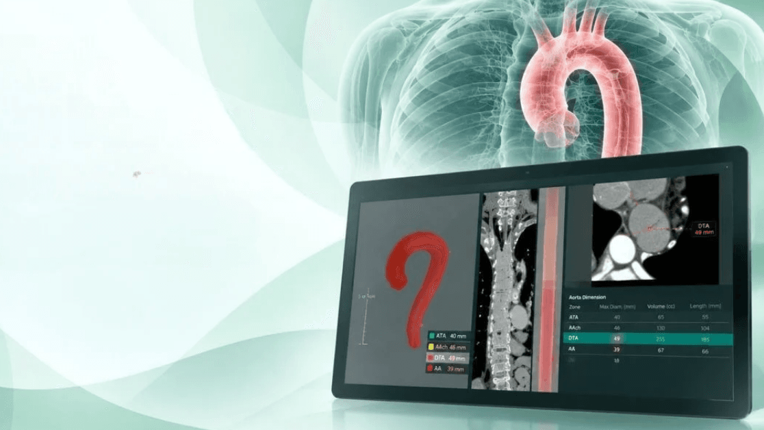 Coreline Soft wins FDA 510(k) clearance for AVIEW Aorta Metrics