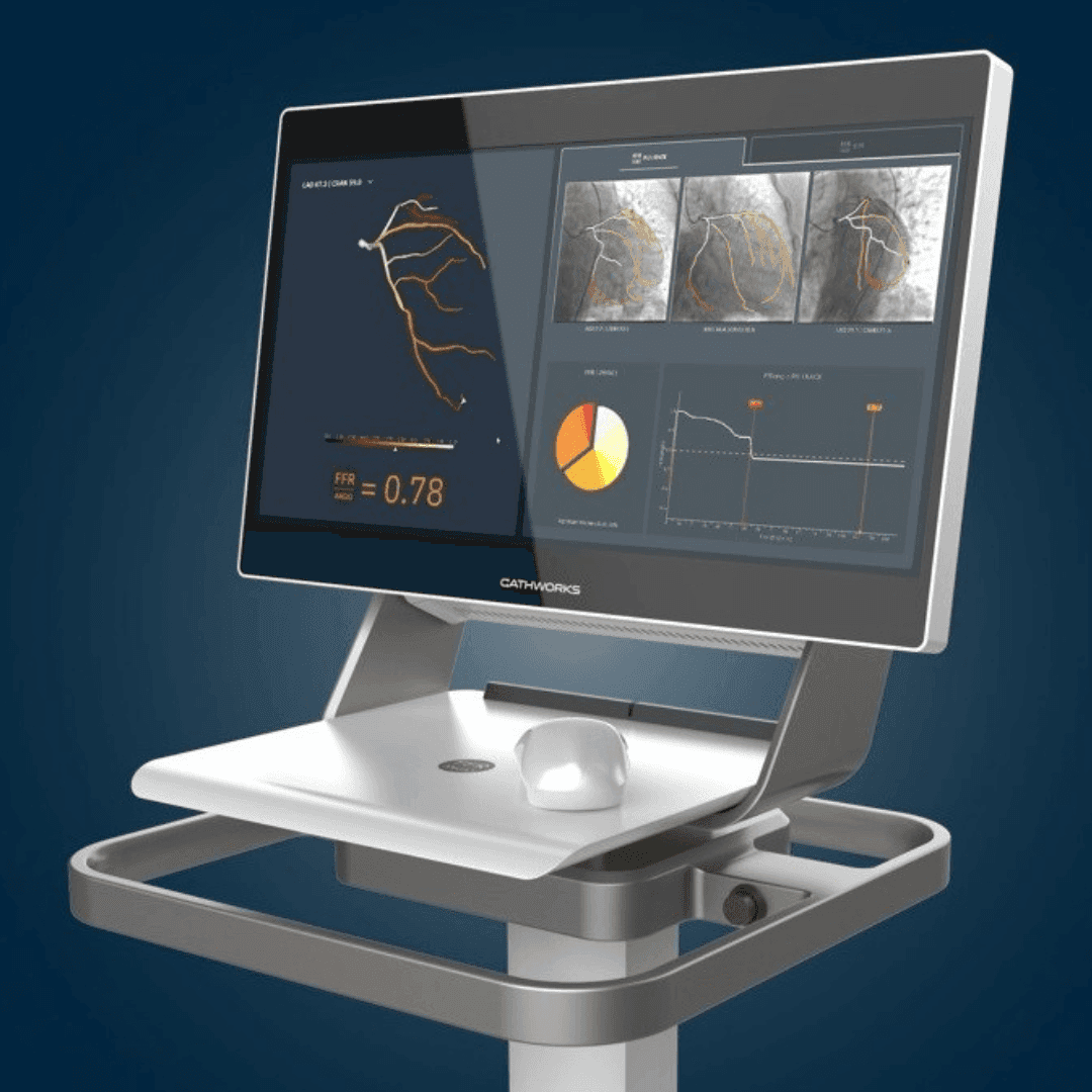 Medtronic advances its innovation strategy with intent to acquire CathWorks