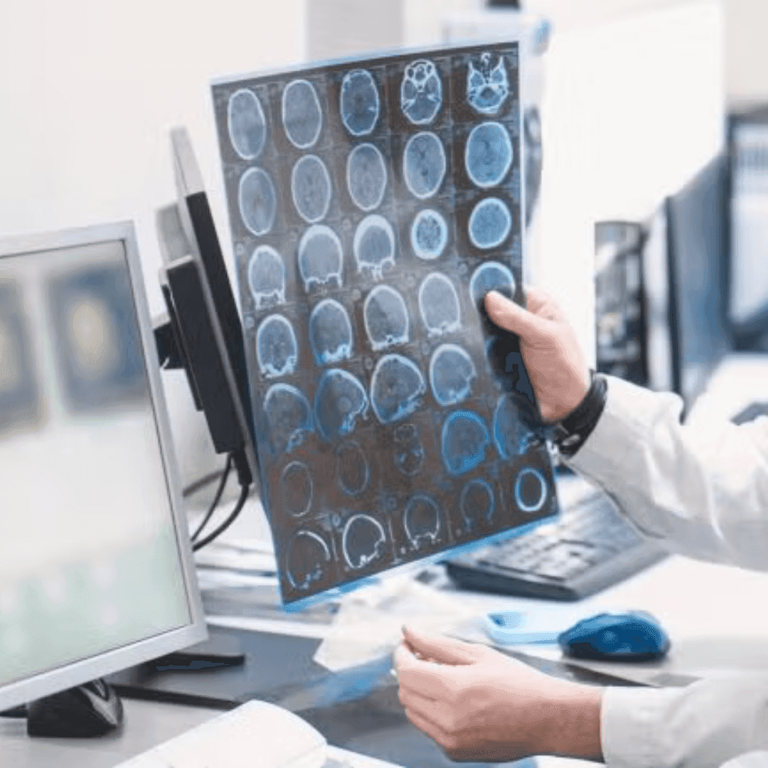 Epiminder conducts first US implant of Minder epilepsy monitoring system