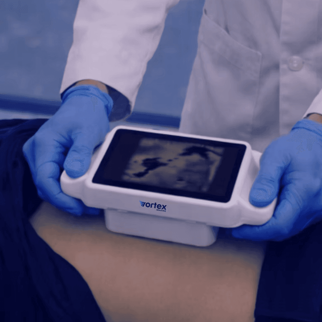 Vortex Imaging secures $12M for 3D imaging expansion