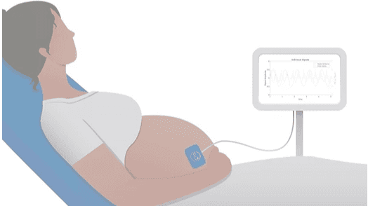 Raydiant Oximetry completes enrollment of First 15 Patients in IDE Pilot Study