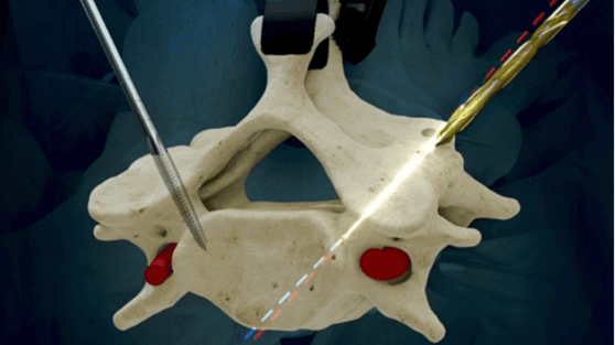 LEM Surgical wins new FDA clearance for humanoid surgical robot