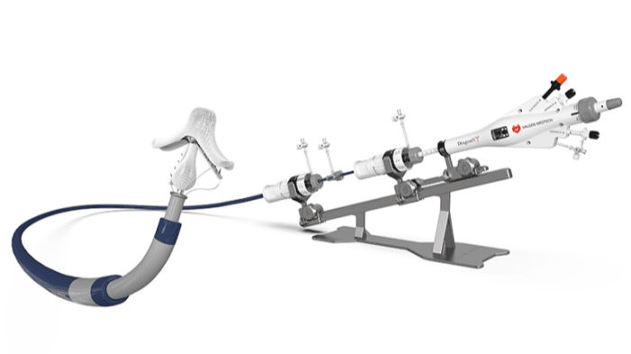 Valgen earns CE mark for mitral valve repair system