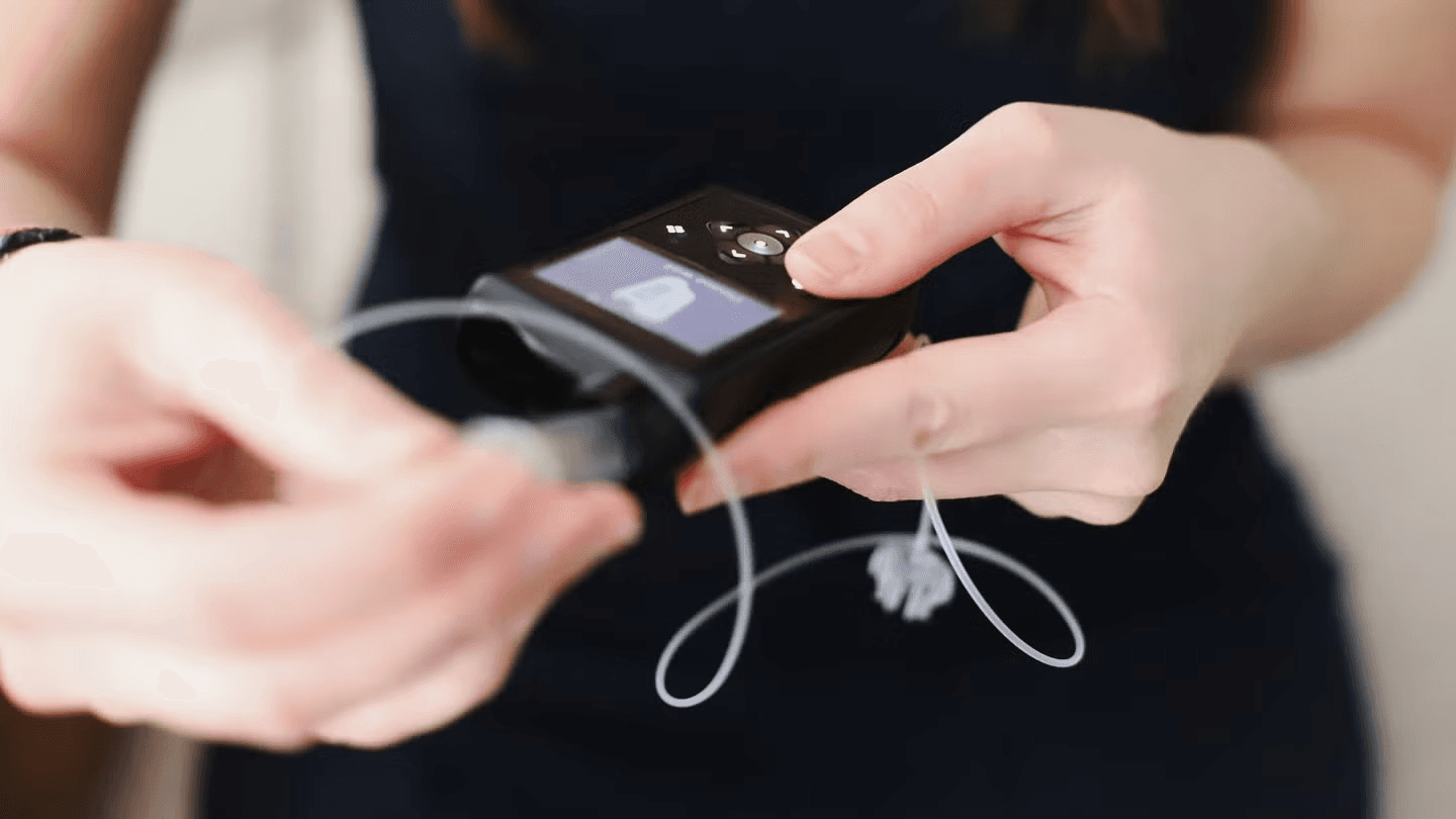Tandem expands CE-marked automated insulin delivery use to pregnancy and type 2 diabetes