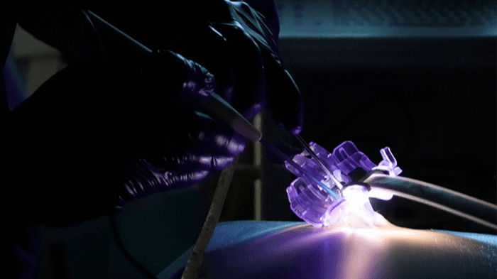 Neo Medical launches access platform for minimally invasive spine surgery
