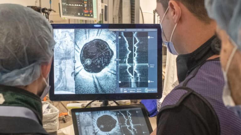 Spryte Medical completes enrollment in FDA IDE trial for neuro-OCT imaging system