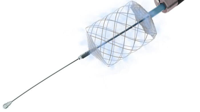 Aqua Medical treats first patient in IDE trial for minimally invasive diabetes therapy