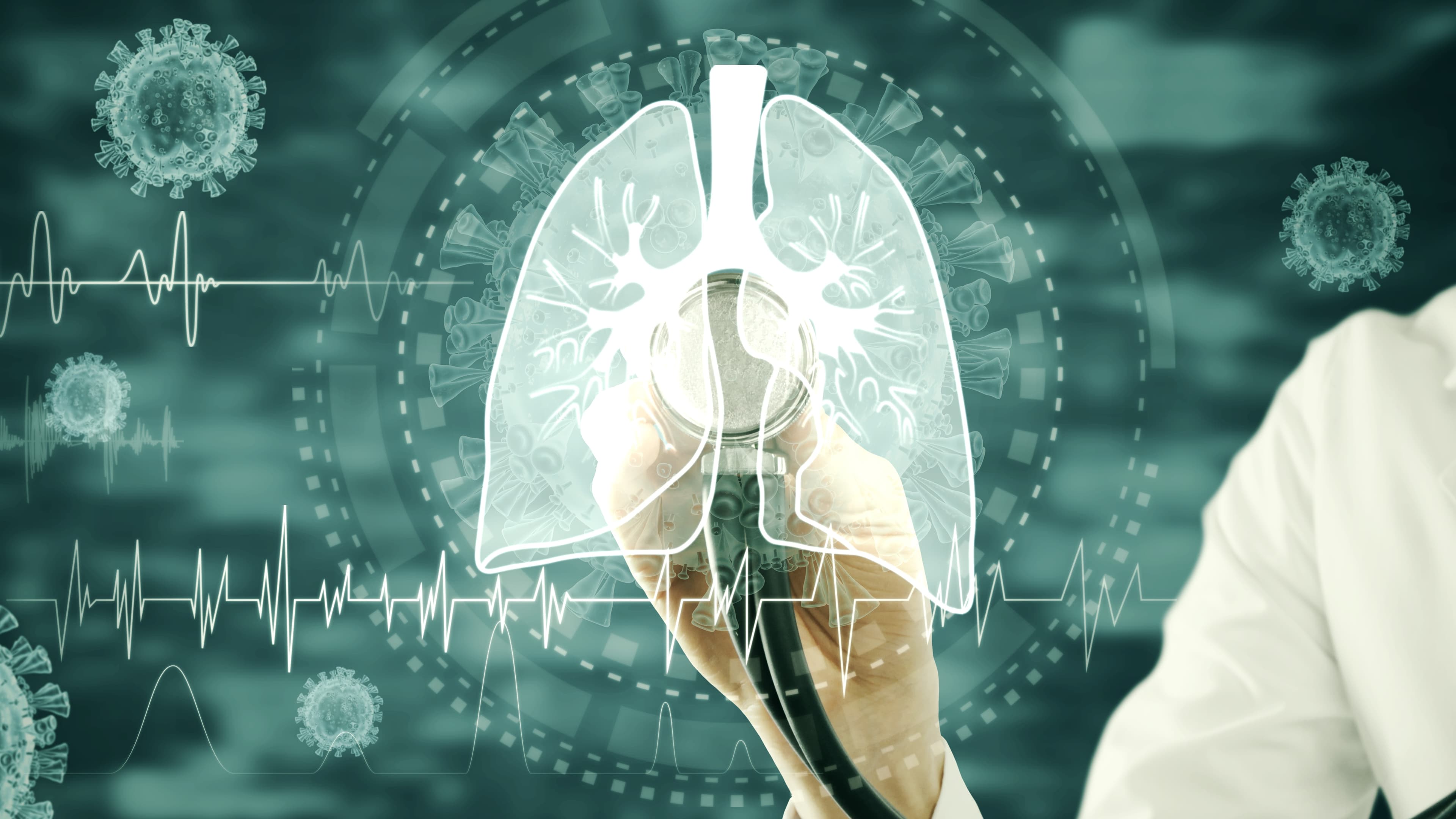 RevealDx partners with 4DMedical to expand AI lung cancer diagnostics globally