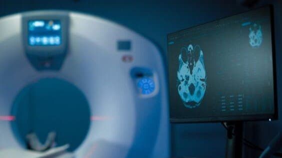 Vexev raises $6M to advance autonomous vascular imaging platform in the US