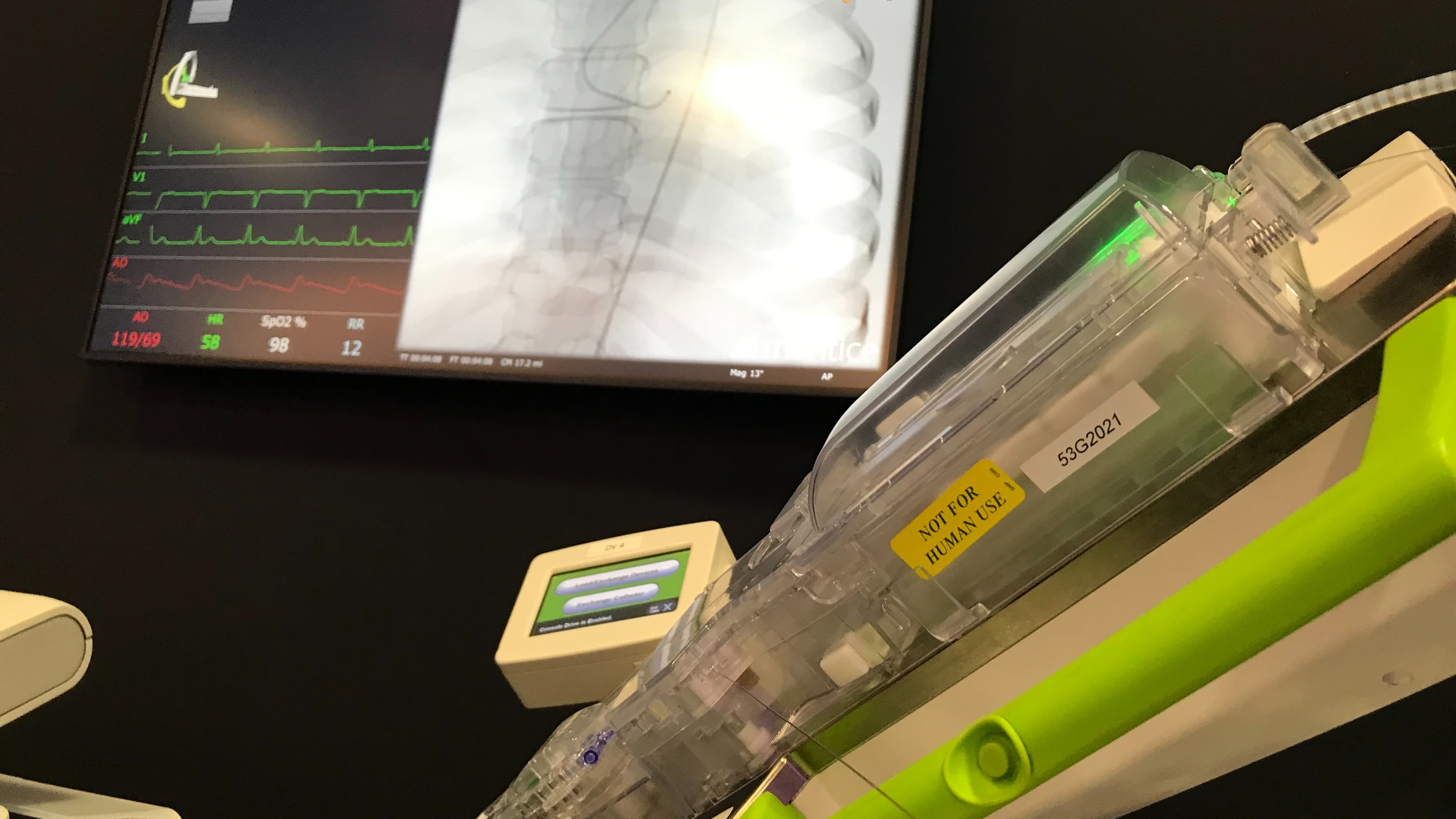 Siemens Healthineers wins $31M in ARPA-H funding to develop remote robotic stroke treatment