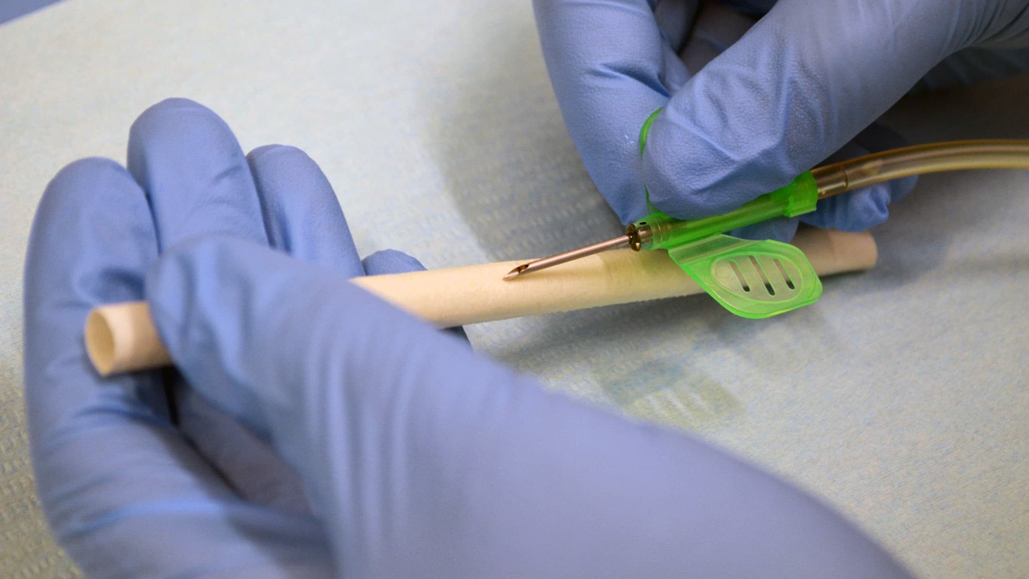Dialybrid raises €15M Series A, completes first human implant of Silkothane Graft