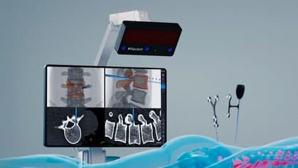 ClaroNav Kolahi receives EU MDR Certification for Navient Surgical Navigation System